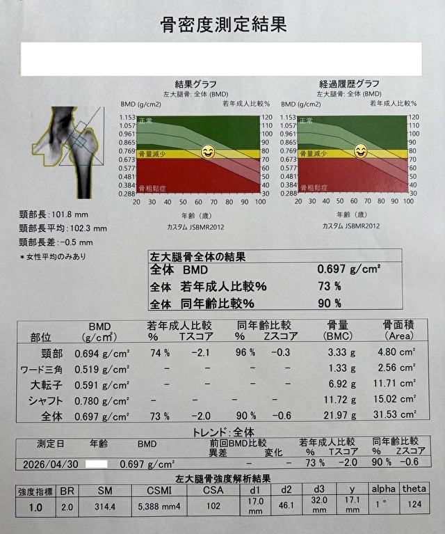 「太ももの付け根」骨密度測定結果